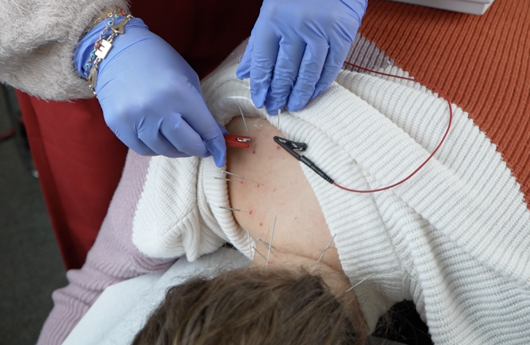 Restore-Health-Chiropractic-DFW-TX-Services-Tabs-Spinal-Dry-Needling